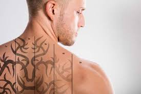 Getting a tattoo is often an impulsive decision that can lead to regrets later in life. What Are The Different Home Tattoo Removal Methods Groovy Ghoulies