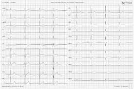 Your satisfaction is our priority. Lead Systems How An Ecg Works Cardiosecur