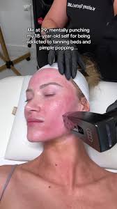Thousands of dollars later in laser treatments & I’m just trying to reverse  the skin damage my 18 year old self caused. She thought aging