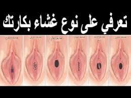 غشاء بكارة سليم