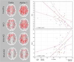 >> 6 detecting zones >> abs materials with ip65 waterproof >> strong aluminum to protect 4 sides so shape won't change >> the power socket is covered under the rainshed working frequency: Human Brain Connectivity Clinical Applications For Clinical Neurophysiology Sciencedirect