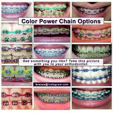 Wow Power Chains Light Up My Patient S Smiles With Fashion Colors Good Looks And Function Close Gaps And Help Toot Cute Braces Braces Tips Braces Colors