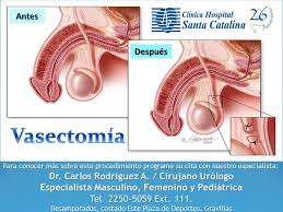 La vasectomía es un procedimiento ambulatorio: En Que Consiste Una Clinica Hospital Santa Catalina Facebook