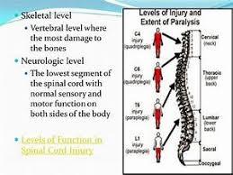 function and spinal cord injury levels chart bing images