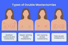 Image result for Modified Apt Test