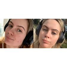 GoodLyfe Laser Medspa