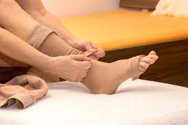 Varicose Veins And Clothing