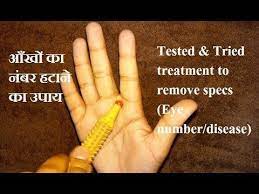 Sujok Therapy For Eyes Acupressure Points For Eyes Acupressure For Eyesight Seed Therapy Youtube Acupressure Treatment Acupressure Points Acupressure