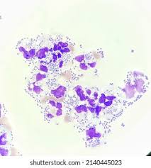Image result for Intracellular Bacteria