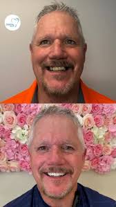 “Because every smile deserves a spotlight” Discover All On 4 Dental  Implants. #wyliedentist #wylie #fyp #dentalcare #implants #smilemore  #smilemore #oralhealth #dentalimplants #dentalimplantswylie ...