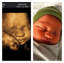 Living Images 3d/4d Ultrasound Studio