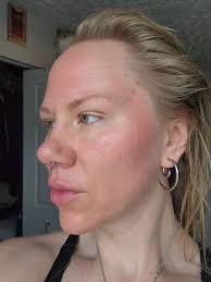 I been loosing a lot of hair the last 2 years but right now is getting very  noticeable I'm feeling very sad, my hair is my favorite thing about my  body, is