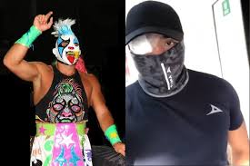 43 pesos con 04 centavos $ 43. Psycho Clown Sufre Sutura En El Ojo Tras Accidente En Arena Neza E Consulta Com 2021