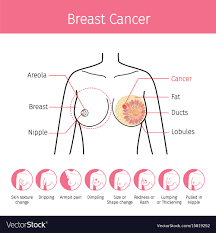Liver anatomy picture function conditions tests treatments. Cm 3129 Female Chest Diagram Wiring Diagram