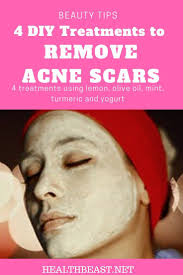 Pin On Acne Scars Products