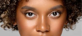 Eye Opening Way to Treat Your Droopy Eye