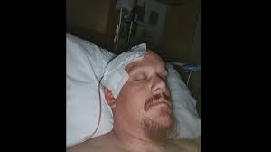 Fundraiser by Matt Marcus : Support Matt's Recovery from Brain Surgery