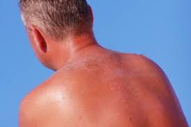 But the best way to avoid all this trouble is, you guessed it, avoiding sunburn in the first place. Decrease Your Risk Of Skin Cancer 2013 07 11 Ishn