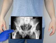 Check spelling or type a new query. Turun Peranakan Gejala Penyebab Dan Mengobati Alodokter