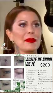 Aceite Tea Tree Bagues Beneficios