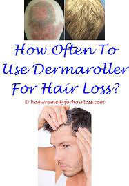 Marijuana might decrease testosterone levels and boost estrogen levels; Pin On Hair Loss Stoppers