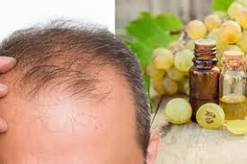 But there are certain facts you must know before you start using eggs for this purpose. Hair Loss Treatment Prevent Alopecia And Stimulate Hair Growth With Eggs Moisturiser Express Co Uk