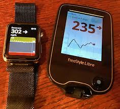 Jewelry you are wearing (rings, watch) may cause. Diabetes Product Review Abbott Freestyle Libre