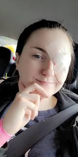 Fungal infection causes partial blindness