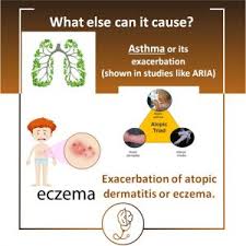 Image result for Allergic Triad