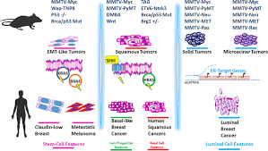 Treatment typically involves some type of surgery and depends upon the staging of the cancer, the tumor type, and the person's health. Histological Subtypes Of Mouse Mammary Tumors Reveal Conserved Relationships To Human Cancers