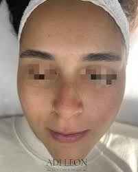 פותחים את השבוע בעוד ניצחון של האקנה!! 🙌🏼 לפרטים ולייעוץ 053-3507120 📱