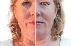 Dermatology Center Philadelphia, Pennsylvania