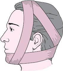 Once your jaw is back in place, it must be kept secure with bandages to prevent your mouth from opening too widely. Jaw Dislocation Mouth And Dental Disorders Merck Manuals Consumer Version