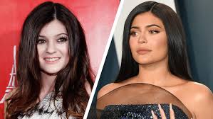 На страницу кайли подписаны более 190 млн человек. The Changing Face Of Kylie Jenner Before And After Closer