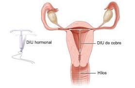 Umetoki barneko gailua
