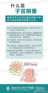 子宫脱垂是什么# ？ 子宫脱垂，是指正常... 来自盐城东方女子医院- 微博