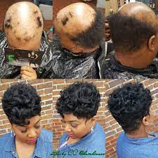 Full Crown Quickweave For Alopecia Client Protective Styles Alopecia Hairstyles Quick Weave Hairstyles Thick Hair Styles