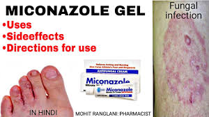 Miconazole Nitrate Cream Uses Sideeffects Directions Fungal Infection Treatment In Hindi Youtube