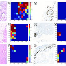 Apartment rent prices and reviews. Pdf Effective Immunohistochemistry Pathology Microscopy Image Generation Using Cyclegan