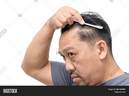 Other novel responses to hair loss are now available in asia. Middle Aged Asian Man Image Photo Free Trial Bigstock