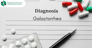 Image result for Galactorrhea