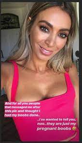 Her zodiac animal is ox. Afl Wag Nadia Bartel Defends Lip Job Claims 9style
