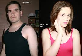 The following example shows a 100px. Feminizing Hormones How To Trans