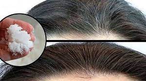 Infatti, è un ottimo rimedio per accelerare la crescita dei capelli. Di Addio Ai Capelli Grigi E Alla Caduta Dei Capelli Con Il Bicarbonato