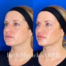 Bellora Medical Aesthetics