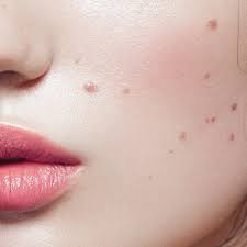 When thinking about beauty spots, marilyn monroe's famous cheek mark. The History Of Beauty Marks 11 Facts About Moles Allure