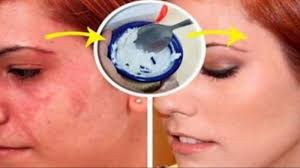 Putihkan gigi campurkan sesudu soda bikarbonat dengan sedikit perahan jus limau nipis. Ternyata Tak Banyak Yang Tahu Baking Soda Punya 15 Kegunaan No 5 Bikin Tampilan Bersinar Halaman All Tribun Jambi