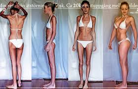 Maybe you would like to learn more about one of these? Linn Stromberg S Incredible Anorexic To Fit 42lb Transformation