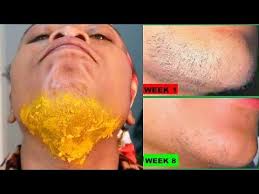 Pcos and unwanted facial hair. Pin On Beauty Ø²ÙŠØ¨Ø§ÙŠÙ‰