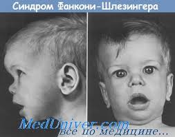 Синдром карликового роста почечного происхождения